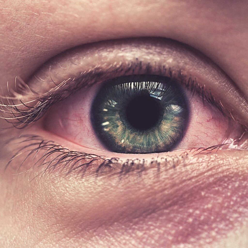 why-does-my-eye-feel-bruised-when-i-blink-eyefacts